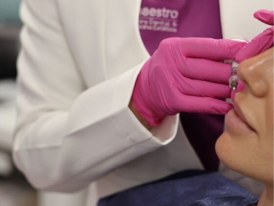 cuidados del rellenos con acido hiauronico en los labios medicina estetica en oviedo